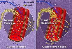 Type 2 Diabetes Overview 10