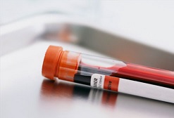 Type 2 Diabetes Overview 11