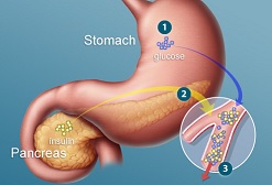 Type 2 Diabetes Overview 9