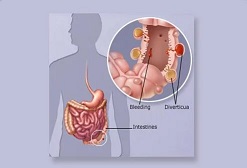 Digestive Disorders 7