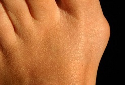 como afecta la diabetes sus pies 10