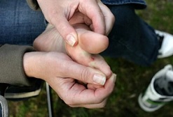 como afecta la diabetes sus pies 9