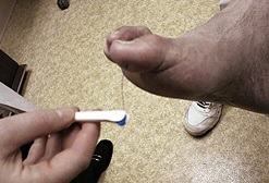 como la diabetes afecta sus pies 2