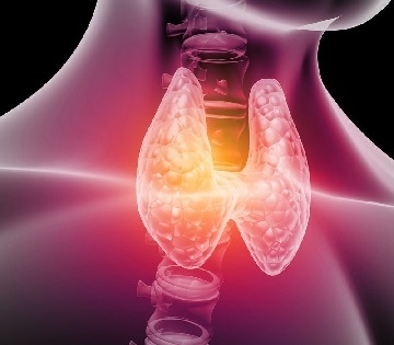 Se sobrediagnostica a las mujeres con cáncer de tiroides 2.jpg