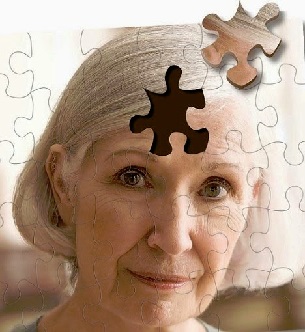 Por qué las mujeres son más propensas a desarrollar la enfermedad de Alzheimer 10.jpg