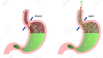 Tu no dices Disculpe, pero ¿debería silenciar su eructo 2.jpg