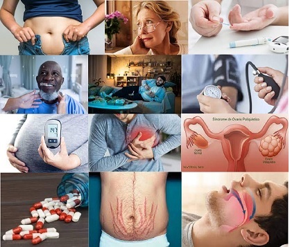 Resistencia a la insulina o diabetes 2.jpg