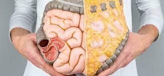 Resistencia a la insulina o diabetes 3.jpg