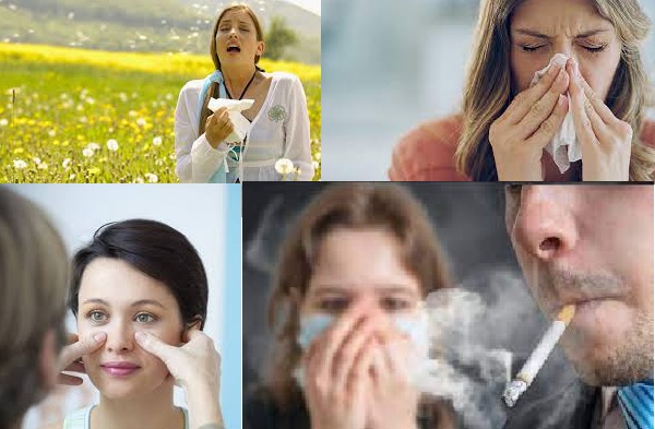 sinusitis aguda 7.jpg