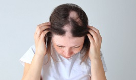 se te cae el pelo 2.jpg