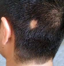 se te cae el pelo 3.jpg