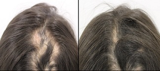 se te cae el pelo 6.jpg