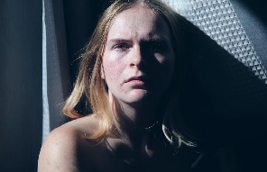 Acné en la mujer adulta Por qué se produce y la carga emocional 5.jpg