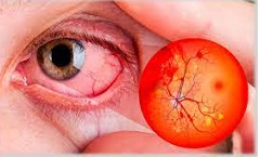 De los ojos a los pies, 8 formas en que la diabetes puede dañar su salud 2.jpg
