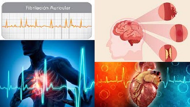 Beber café se relaciona con un corazón más sano y una vida más larga 2.jpg