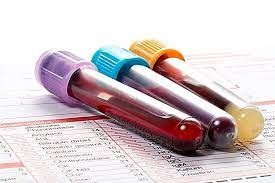 Las pruebas de cribado pueden salvar vidas 2.jpg