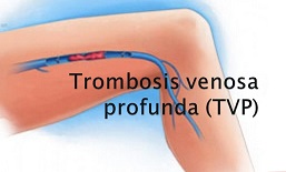 12 Detecte las señales de advertencia de 4 situaciones peligrosas.jpg