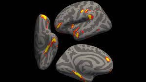 7 COVID-19 daña el cerebro.jpg