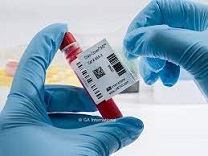 18 Dónde puede hacerse análisis de sangre.jpg