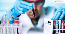 2 Dónde puede hacerse análisis de sangre.jpg