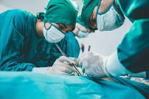 13 Prevención del cáncer de ovario Deberían las mujeres plantearse la extirpación de las trompas de Falopio.jpg