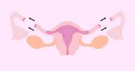 14 Prevención del cáncer de ovario Deberían las mujeres plantearse la extirpación de las trompas de Falopio.jpg