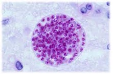 7 Afectan nuestros microbios a nuestro comportamiento.jpg