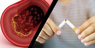 2 El grave problema de las cardiopatías.jpg