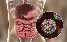 2 Fue algo que comiste Sigue estos pasos cuando la comida te siente mal.jpg